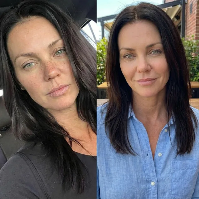Pure Dose Skin: I Took Astaxanthin Pills for 6 Months.